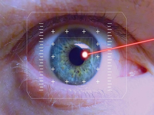 Laser Correction of Poor Vision